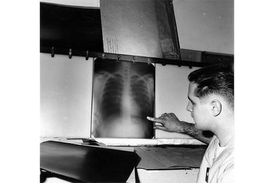 An unidentified radiologist examines a chest X-ray at the 44th Surgical Hospital (Mobile Army).